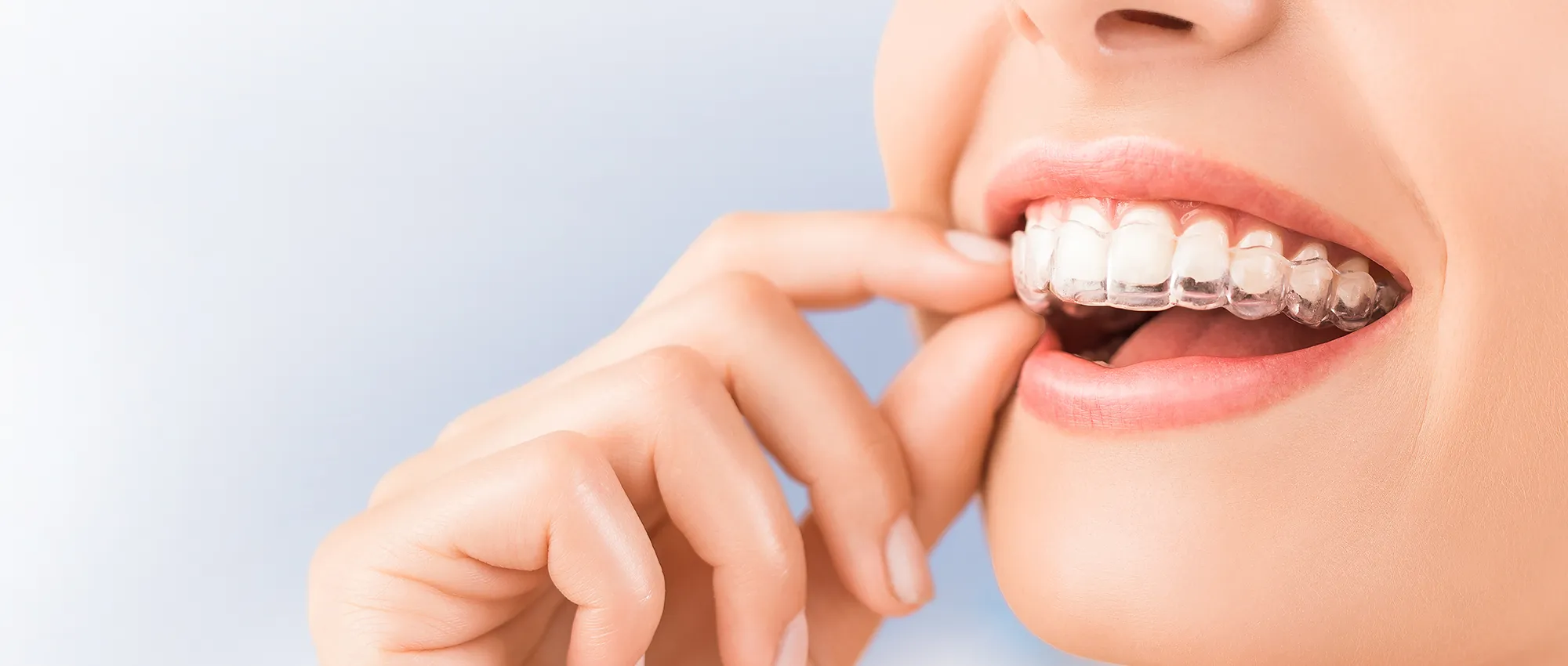 Orthodontic Treatment_lg