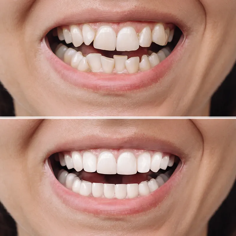 implantspg oxford dentistry
